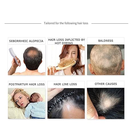 Serum Natural Anticaida de Cabello - Estimulante Crecimiento™